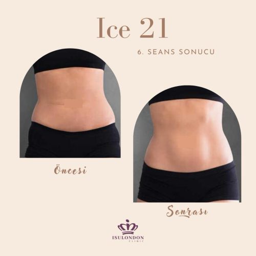 ice-21